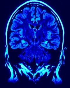 Brain Scan